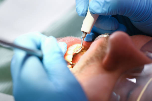 Best Emergency Treatment for Toothache in Granite Bay, CA